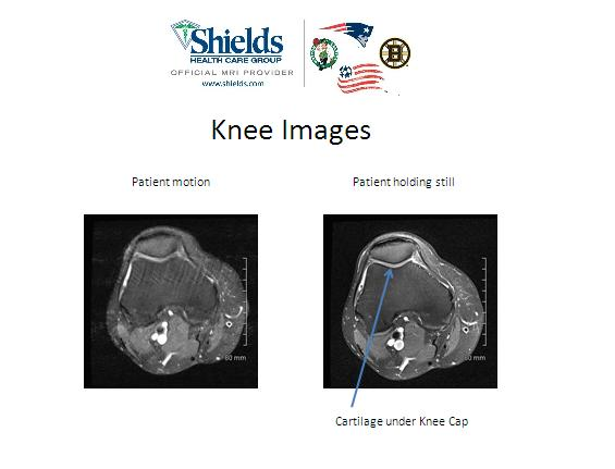 knee motion resized 600