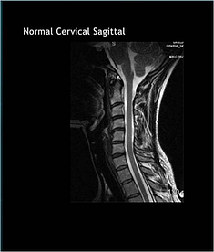 normal cervical spine resized 600