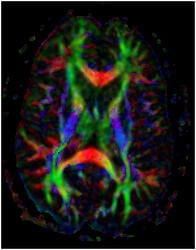 figure2concussion