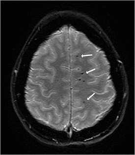 figure1concussion resized 600